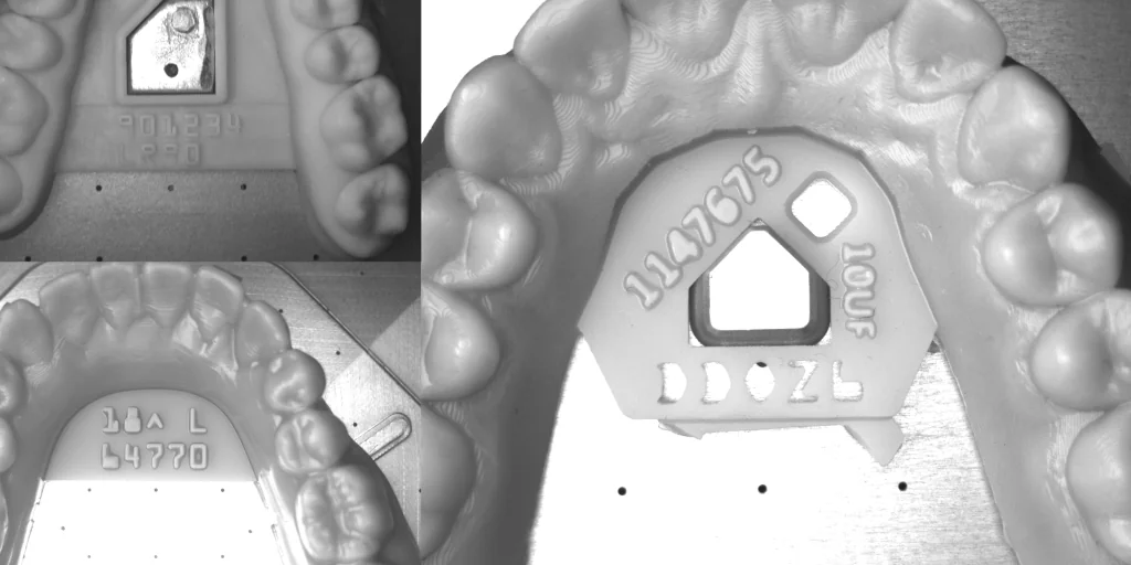 Sample engravings from multiple aligner batches